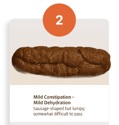 Bristol stool chart type two, lumpy sausage